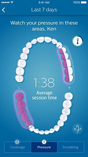 Smart 9300 Rechargeable Electric Power Toothbrush, Black, HX9903/11