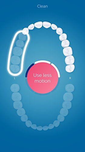 Smart 9300 Rechargeable Electric Power Toothbrush, Black, HX9903/11