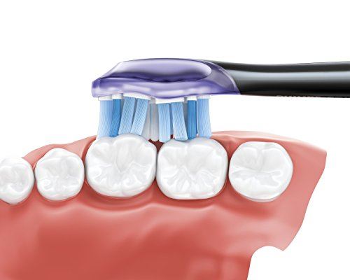 Smart 9300 Rechargeable Electric Power Toothbrush, Black, HX9903/11